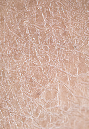 추천 타입 이미지 1